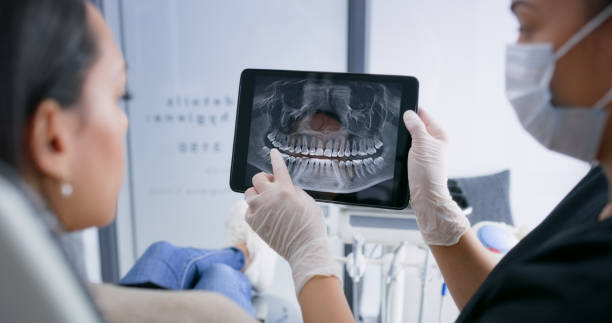 Licensed Wisdom Tooth Removal service in Santee, CA - Smile Center Dentistry